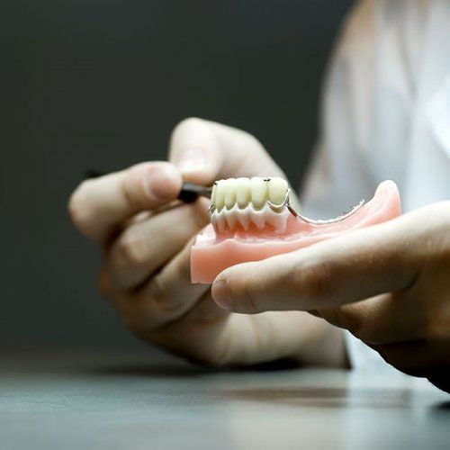 Prótesis dentales sur de Madrid Prótesis dentales sur de Madrid